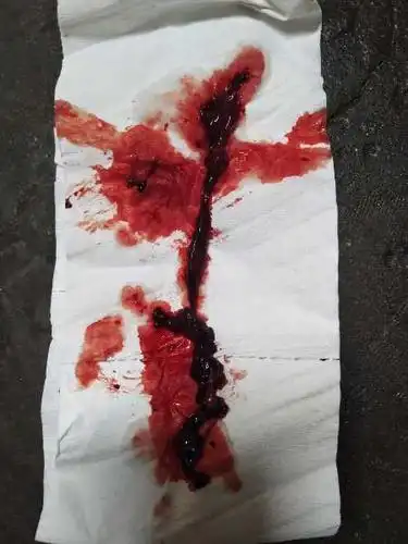 经血这样是怎么回事?